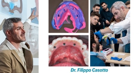 Diagnosi e progettazione chirurgo-protesica nei full arch - Odontoiatria Italia
