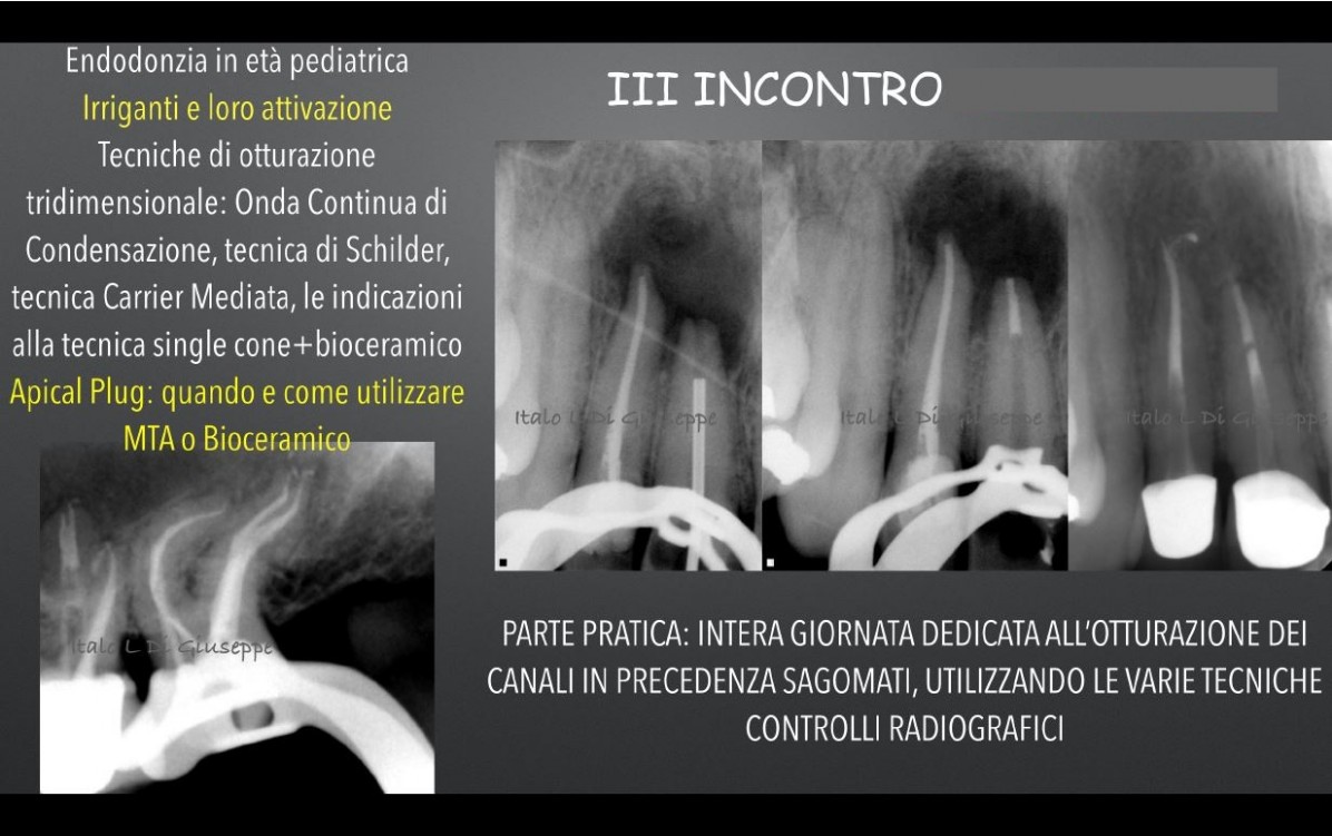 Dr. Italo di Giuseppe - Corso Endo, foto 3
