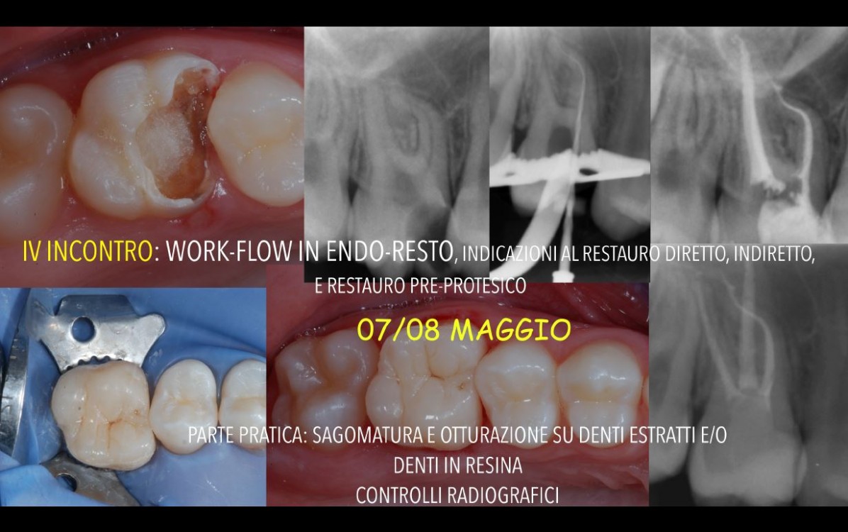Dr. Italo di Giuseppe - Corso Endo, foto 4