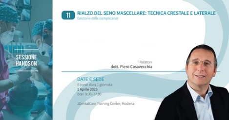 Rialzo del seno mascellare - dott. P. Casavecchia