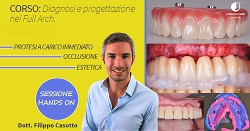 Dott. Filippo Casotto: Diagnosi e progettazione full arch