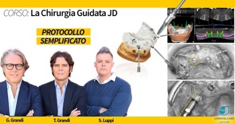 La chirurgia guidata jd - Protocollo semplificato