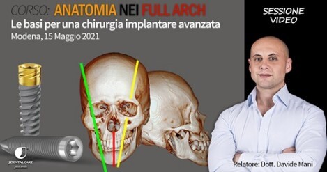 Dr. Davide Mani: Corso chirurgia implantare avanzata