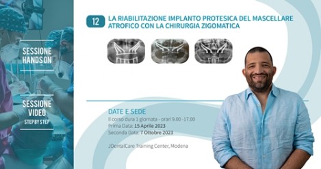 Riabilitazione implanto protesica - dott. Matteo Giorg