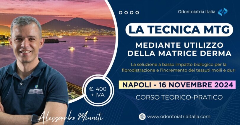 La tecnica MTG a Napoli | dott. Alessandro Minniti | Odontoiatria Italia La tecnica MTG a Napoli | dott. Alessandro Minniti | Odontoiatria Italia