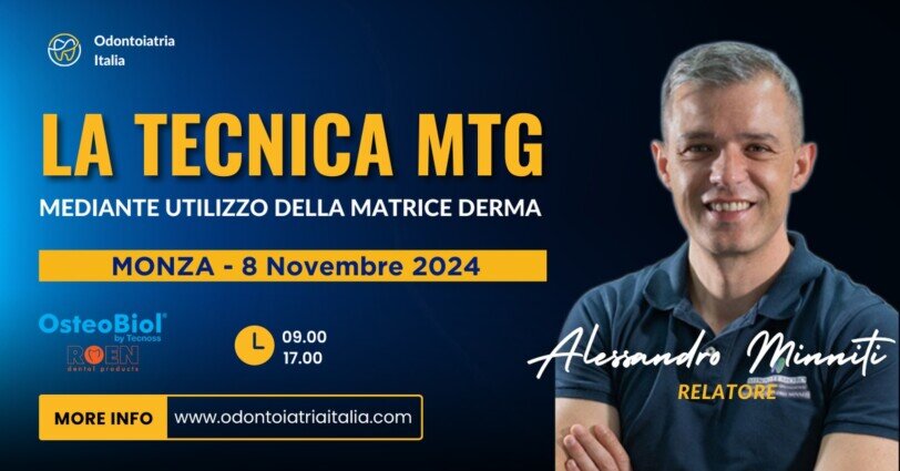La tecnica MTG - Monza | dott. Alessandro Minniti | Odontoiatria Italia La tecnica MTG - Monza | dott. Alessandro Minniti | Odontoiatria Italia